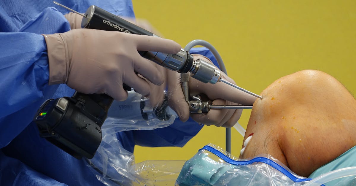 découvrez tout sur le genou : anatomie, douleurs, traitements et conseils pour bien prendre soin de vos genoux au quotidien.